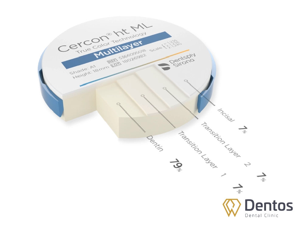 Răng sứ Cercon HTML kết hợp hoàn hảo giữa độ trong mờ cao và cấu trúc màu đa lớp